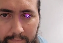 Perdió un ojo y ahora transformó su cabeza en una linterna cibernética