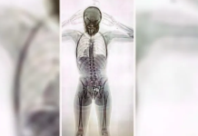 Aeropuerto de Ezeiza: detuvieron a una joven de 20 años con 78 cápsulas de cocaína en el cuerpo