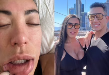 Las impactantes fotos que Pamela Pombo presentó en la causa contra su exmarido Patricio Albacete